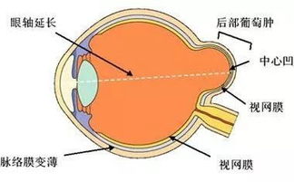 眼睛检查的验光和散瞳，都伤眼睛，为什么还要做呢