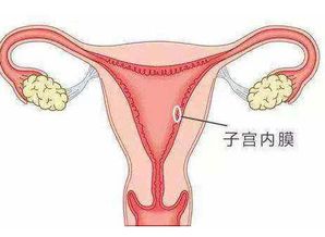 高龄子宫内膜变薄还可以试管好孕吗？
