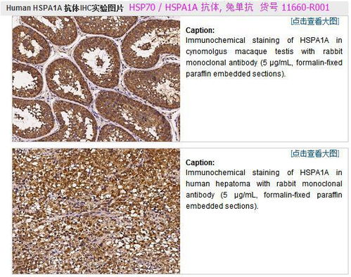 免疫组化hsp70 是什么意思 