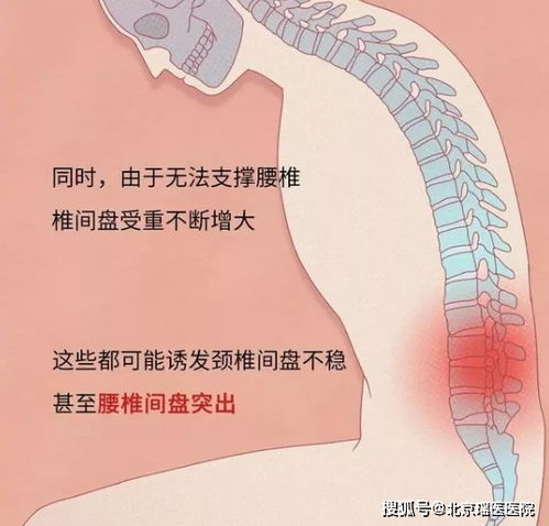 上厕所玩手机可能让你 从头伤到脚 看完你还敢玩吗