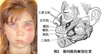 牙痛严重真的会要命,别再不把牙痛当回事