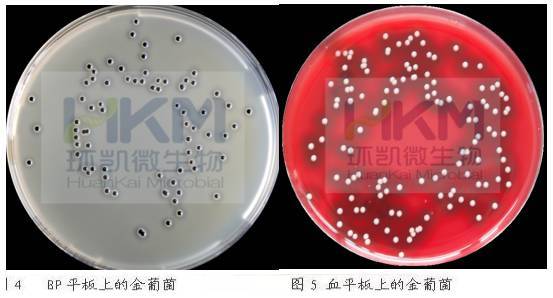 食品中金黄色葡萄球菌的检测方法有哪些？