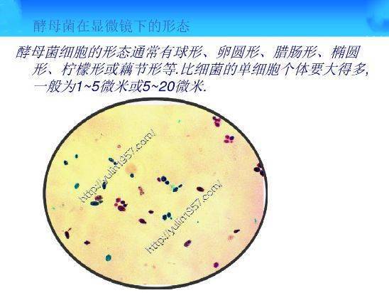 常见微生物菌落形态特征