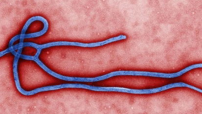 埃博拉病毒病，埃博拉病毒在哪个国家爆发