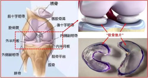 主播薇娅半月板损伤做手术上热搜,这个病我们都要小心