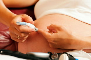 妊娠期缺乏维生素D对孕妇及其子代的影响：综述