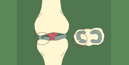人老腿先衰 最毁 膝盖的3种行为,很多人都中招了