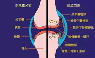 福利 明天,顺义区医院免费测骨密度啦 