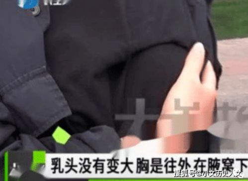 年轻男子做面部整形,结果变丰胸 含泪哭诉 丰胸还失败了