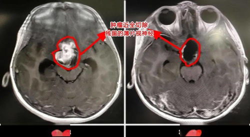 医生手记 他们的话,给了我 放手一搏 的底气