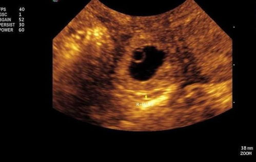 怀孕50天能查出胎心胎芽吗,怀孕五十天能不能查出胎心胎芽