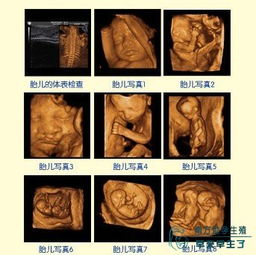 七个月胎儿四维彩超，怀孕7个月可以做四维吗
