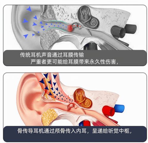 骨传导耳机漏音严重吗 有没有漏音小的骨传导耳机