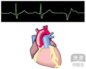 生活噪音可引发心律失常 引发心律失常的原因都有哪些