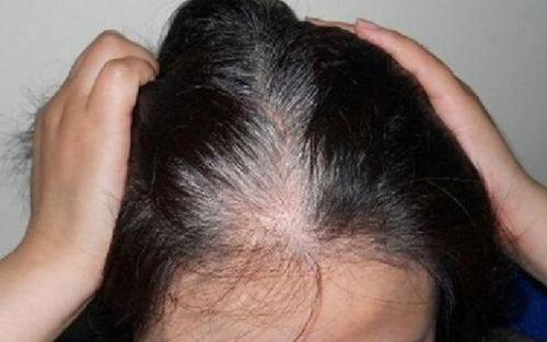 白发长在哪,病就从哪出 长在前额 两鬓 后脑勺,分别代表什么