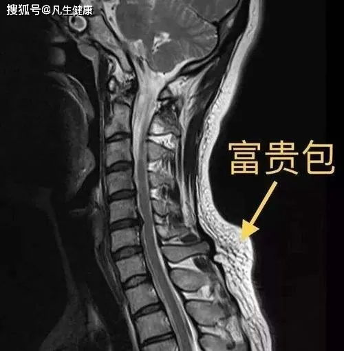 富贵包的 诞生 与 毁灭 下篇