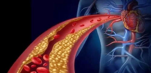 人体内的胆固醇升高与什么因素有关 看看他们是怎么说的