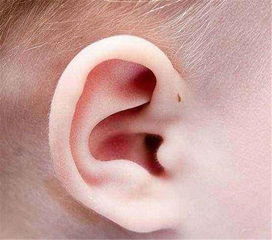 为什么有些孩子生出来耳朵有个 小孔 不是福气,家长别大意