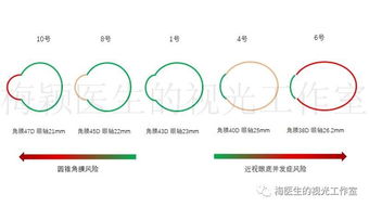 医生,请问孩子近视200度带150度散光,能戴角膜塑形吗