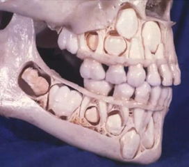 小孩换牙前的颅骨图，人为什么只能换两次牙齿呢