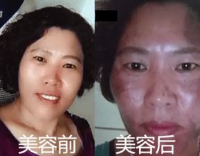 郑州一女子被 毁容 看完后感叹 套路太深