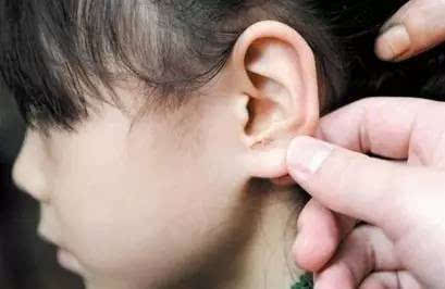 17岁男孩突然耳朵聋了 可怕,这个习惯很多荆州伢也有 