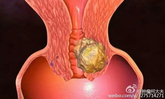 tct是检查什么的，TCT检查是检查什么