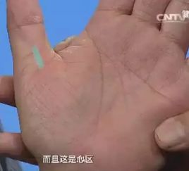 吉宝原手诊 通过手掌查看健康状况 10种疾病轻松看出 