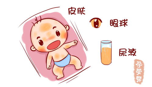 新生儿黄疸临床三种干预方式,新生儿黄疸干预方案是怎样的?