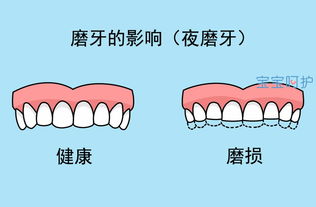 半夜会磨牙是什么原因引起的（半夜磨牙是什么原因引起的六岁） 第1张