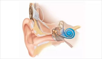 人工耳蜗植入后对耳鸣有影响吗 耳鸣会消除还是加重
