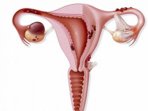 输卵管妊娠：不想输卵管受损，应如何进行防护？这3件事需做好