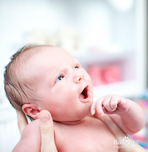 小孩子湿疹图片？刚满一个月的婴儿长湿疹怎么办