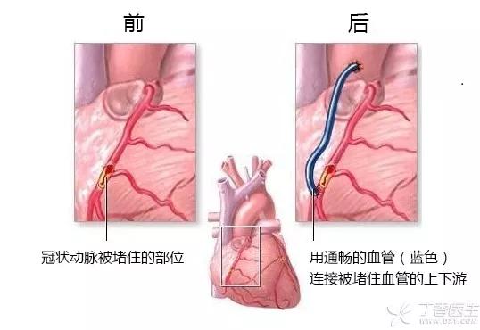 我国2.9亿人患病,死亡率最高的居然是它