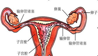 原创输卵管堵塞怎么办？试试这2个“小技巧”，或许能助你接“好孕”
