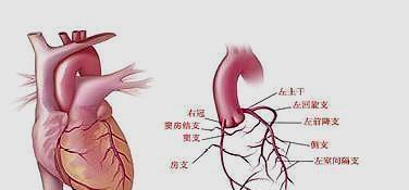 心脏造影有危险吗(80岁老人做心脏造影有危险吗)