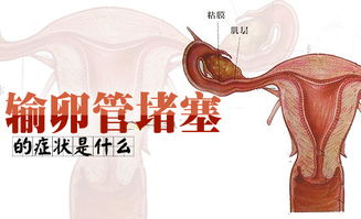 聊城女性输卵管堵塞怎么回事[热点排行]济南红绘