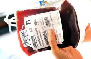熊猫血献血有优待吗