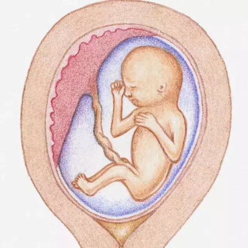 怀孕四个月胎儿，怀孕四个月胎儿是什么样子的