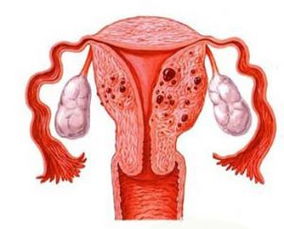 子宫腺肌症的症状表现,子宫腺肌症的症状表现有哪些呢?