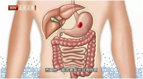 这层不到1毫米的黏膜,既是器官 保护神 ,也是肿瘤 发源地