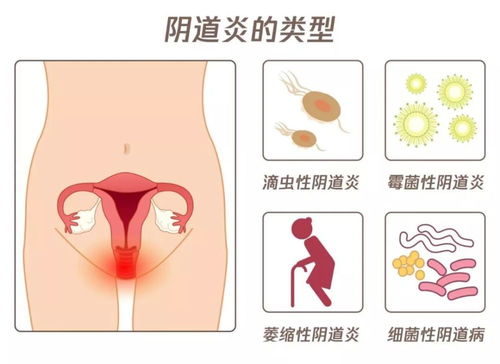 女人乳头发黑是怎么回事 多少女性被它的 污名 折磨