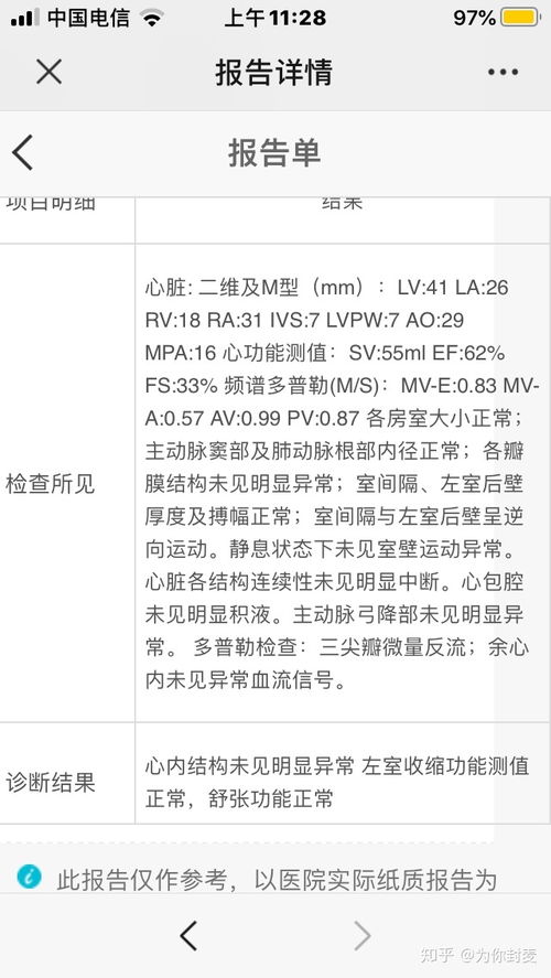 征兵体检正式体检心电图没过,第一次复查心电图过了之后征兵网上还显示复查待定,然后又通知复查是什么意思 