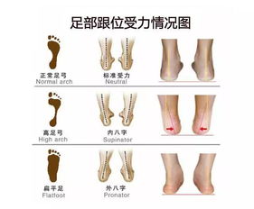 走路脚疼 可能是穿错了鞋子 医生提醒 这种流行款很多人不适合,特别是孩子 平足 
