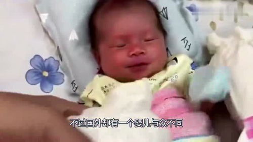 全美的14斤 巨婴 ,如今30多年已过,你对现在的他好奇吗 