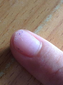 指甲软化怎么弄好看 中学生的指甲怎么变好看