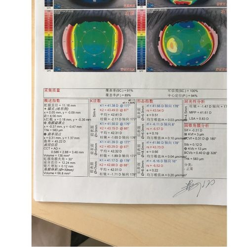 兰州全飞秒手术经历像过山车,预估0.8,结果傻眼