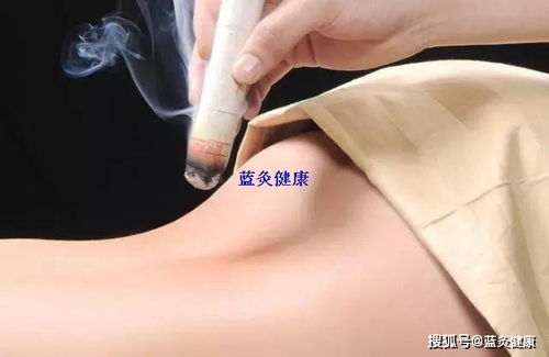 艾灸后脸上排毒反应(艾灸后脸上排毒反应怎么办)