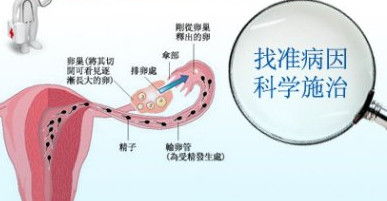 泰安哪里能做输卵管导丝介入[今日解读]济南红绘