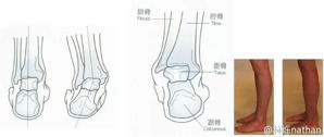 关于大腿围度